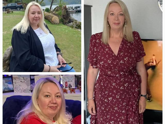 Sharon before and after her weight loss.