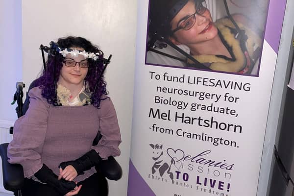 Melanie Hartshorn has walked for the first time after undergoing surgery.