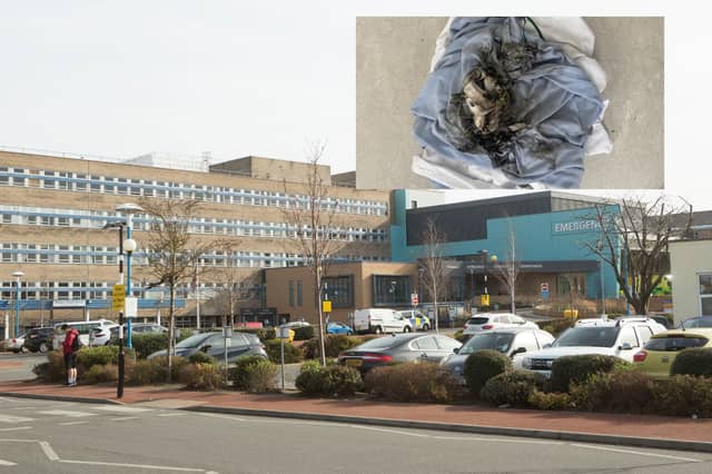 The fire is reported to have taken place at Sunderland Royal Hospital. Inset - the fire damage to a bed blanket.