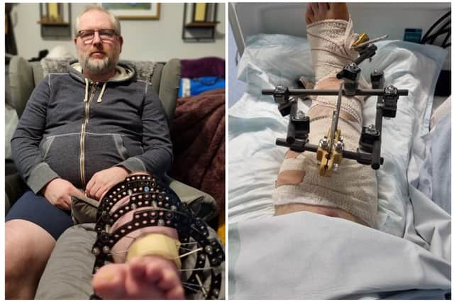 Mark Kitchin suffered life-changing injuries when he was struck by a car