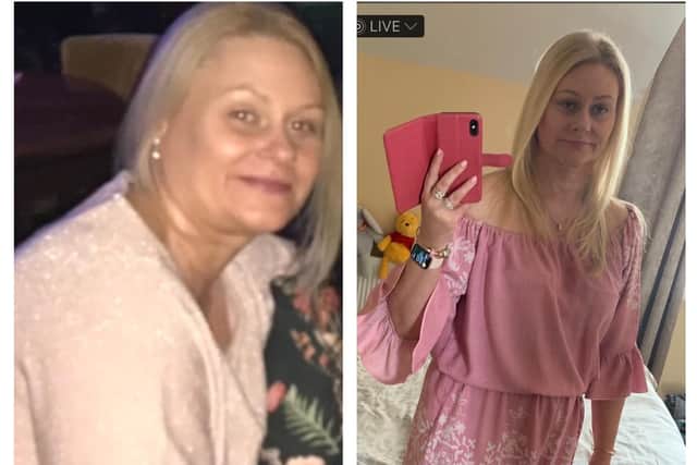 Before and after Sharon's weight loss journey