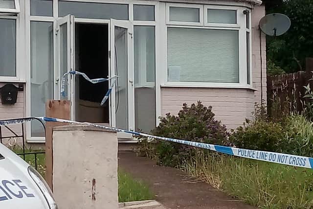 Man suffered serious burns to his face in house fire as woman arrested ...