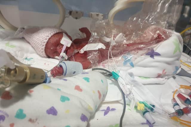 Tiny Charlotte Smith in hospital after being born 16 weeks early.
