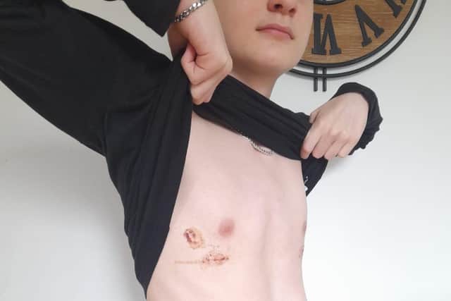 Jacob shows off his new-look chest.