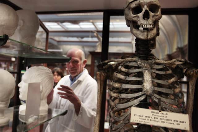 The skeleton of William Burke, pictured before it went on display after a revamp of the Anatomy Museum at the University of Edinburgh. Picture c/o David Cheskin/PA Wire.