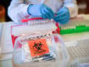 Lab technicians handle suspected COVID-19 samples as they carry out a diagnostic test for coronavirus. Picture by Ben Birchall/PA Wire