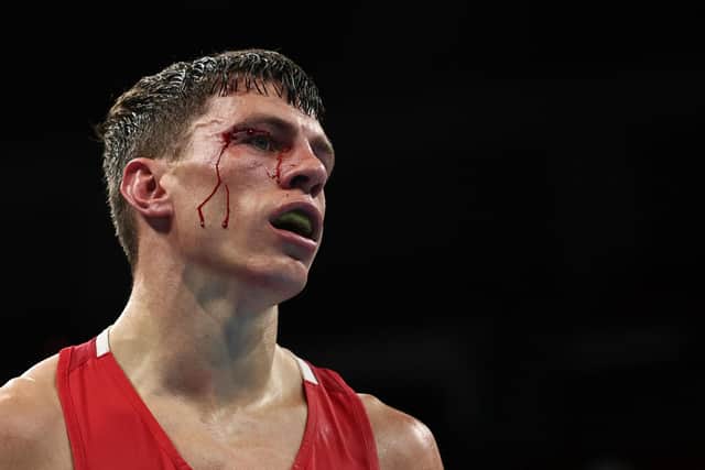 Britain's Pat McCormack is injured as he fights Uzbekistan's Bobo-Usmon Baturov during their men's welter (63-69kg) quarter-final boxing match at the Tokyo 2020 Olympic Games at the Kokugikan Arena in Tokyo on July 30, 2021.