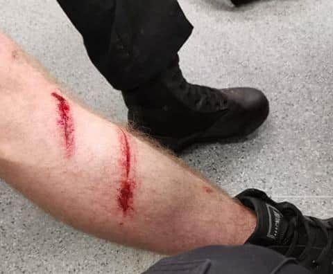 A photo shared by Durham Constabulary showing the injuries a PCSO sustained after being attacked.