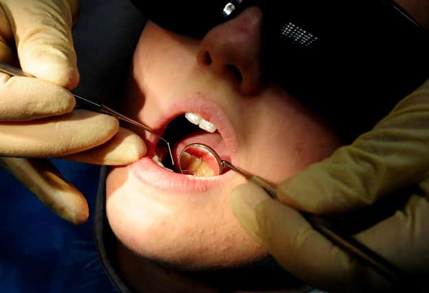 Child tooth extractions concerns.