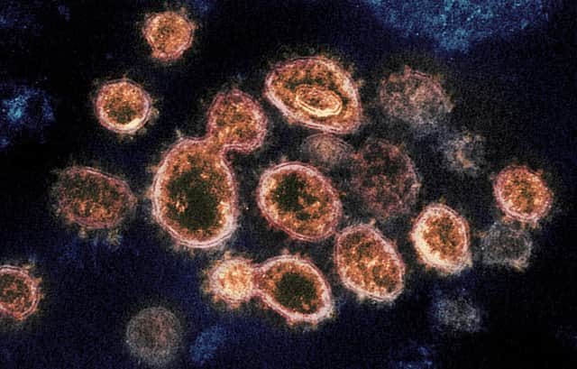 Coronavirus cells under the microscope