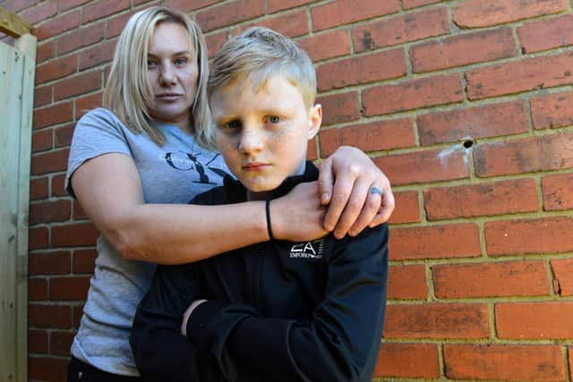 Donna Jones with son Charlie Jones, 11 following an attack at Easington Lane.