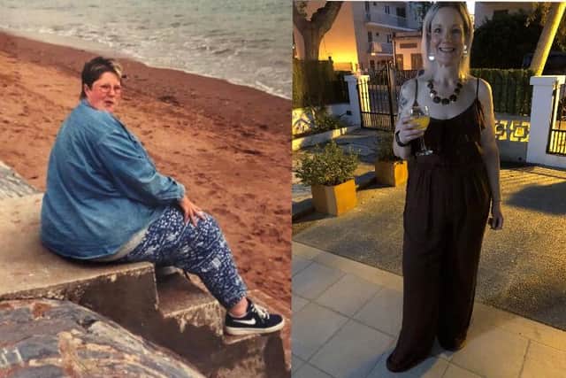 Before and after picture of slimmer Sue Thompson