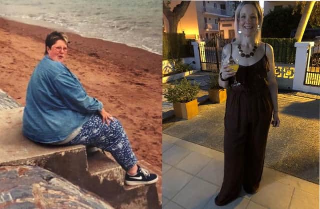 Before and after pictures of slimmer Sue Thompson