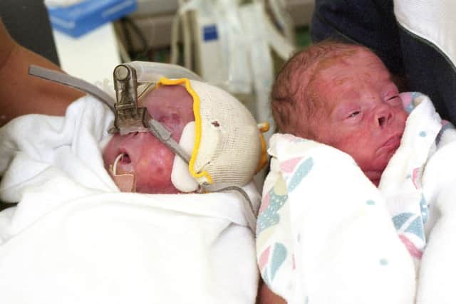 Twins Jack (left)  and Thomas Ferry from Southwick, born 16 weeks prematurely in 2001, weighing just 3lb between them.