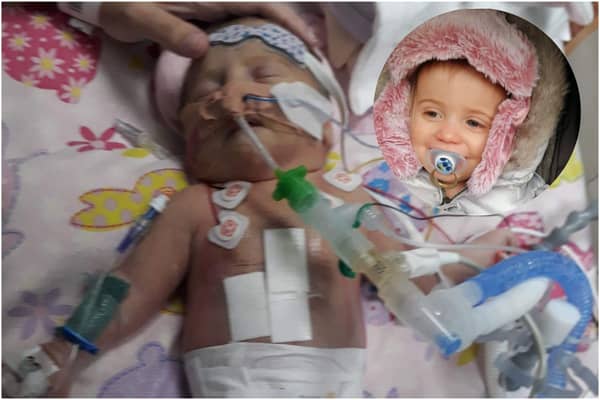 Little fighter Lily McKenzie was fitted with a pacemaker at just 12 hours old.