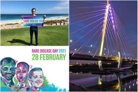 Sunderland landmarks will be lit for Rare Disease Day 2021