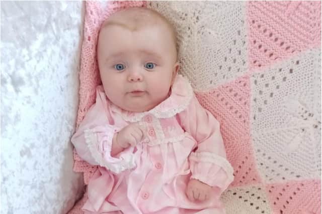 Dolcie was the third baby in the UK to receive the £1.8 million treatment on the NHS.