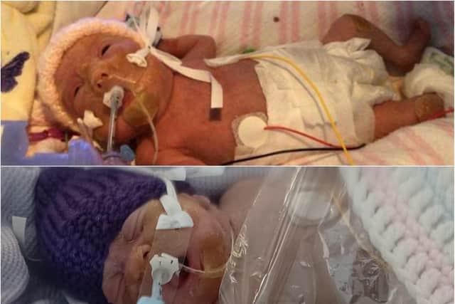 Riley's twin sister Robyn is still being looked after in Sunderland Royal's neonatal unit.