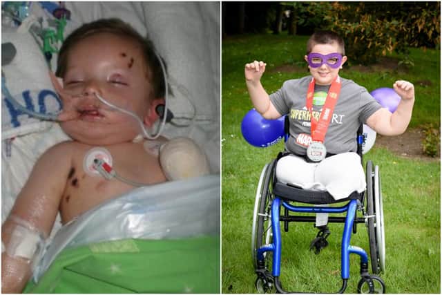 Robbie Jones has come a long way since he became ill with meningitis at just 21 months old.