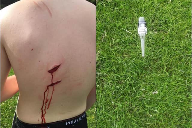 A 13-year-old boy was injured after falling on a broken wine bottle in a Washington field.