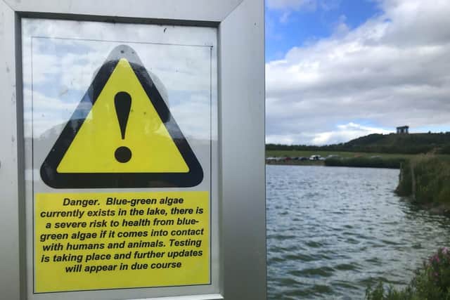Signs in Herrington Country Park. (Photo by Ian McClelland Media)