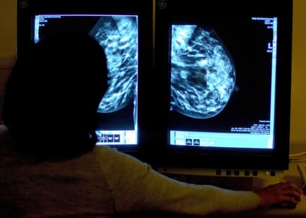 A consultant studying a mammogram. Picture by PA Wire/PA Images