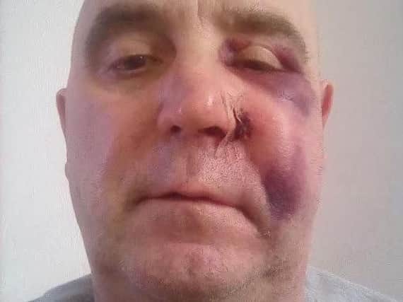 This man was left with facial injuries after being assaulted.