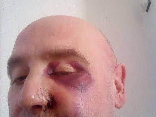 This man was left with facial injuries after being assaulted.