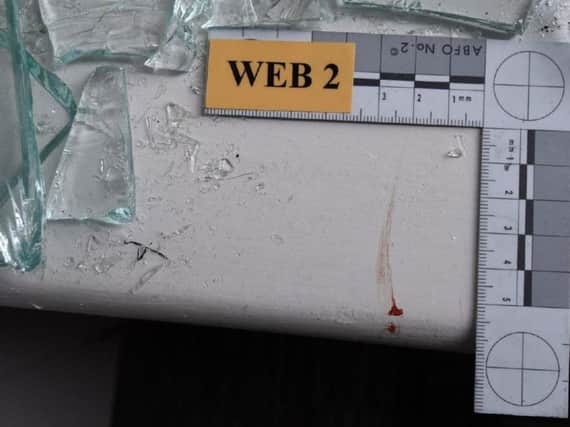 Blood left by Wayne Carr after he raided a Sunderland dental practice.