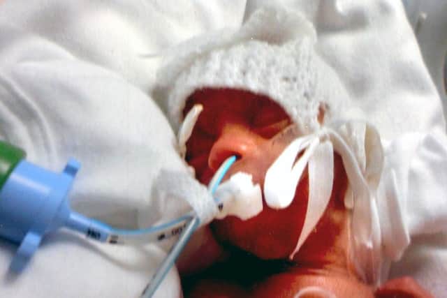 Tragic Alfie Briggs, who died at just a month old after being born prematurely.