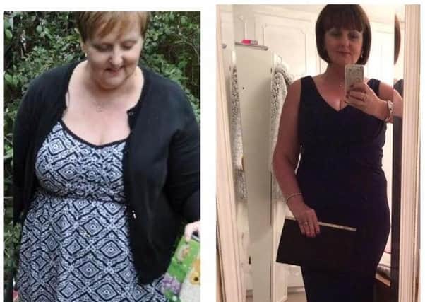 Sue Kerr before and after her weight loss.