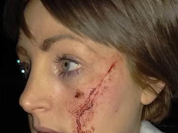 Vicky Bowes who had her face slashed after answering the door.