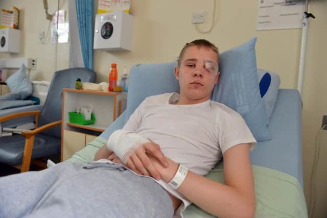 James Elgy, aged 15, is in hospital after being shot in the face with an air weapon.