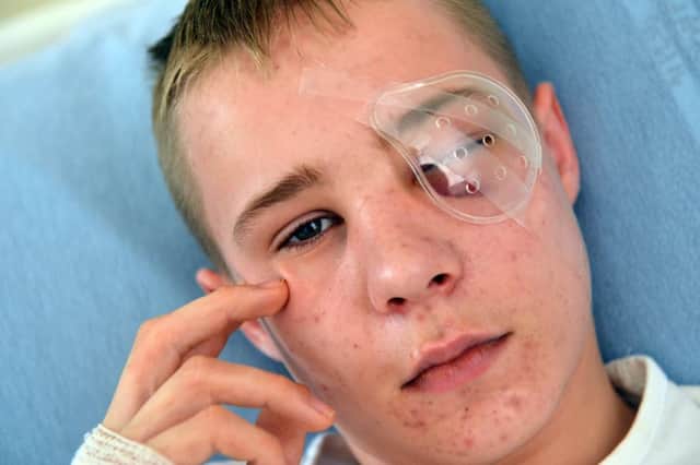 James Elgy aged 15 was shot in the face with an air weapon.