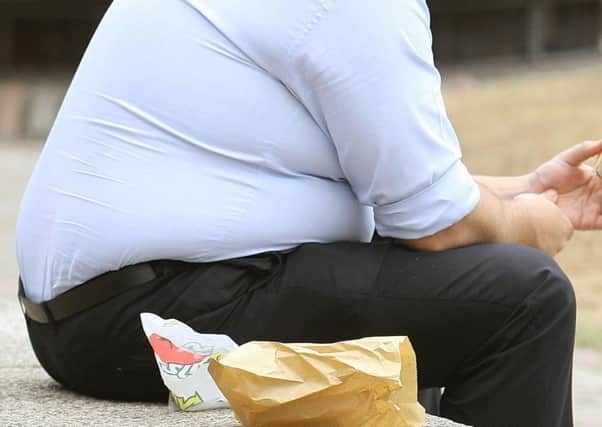 Sunderland has the highest rate of hospital admissions in the country as a result of obesity, according to new figures.