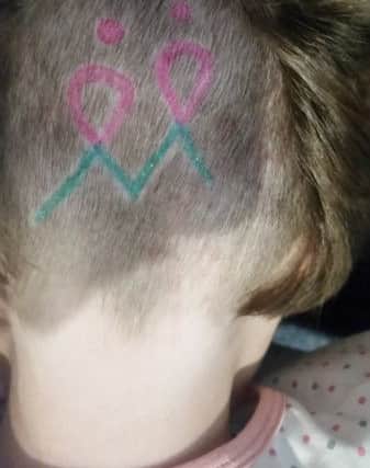 Mia Rose Smith had the logo of Second Hope shaved onto the back of her head.
