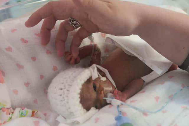 Tilly Scott, who died just a month after being born at 17 weeks in July 2015.