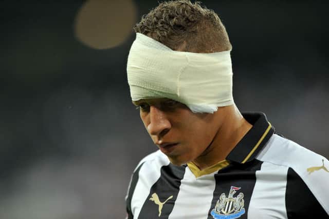 Dwight Gayle