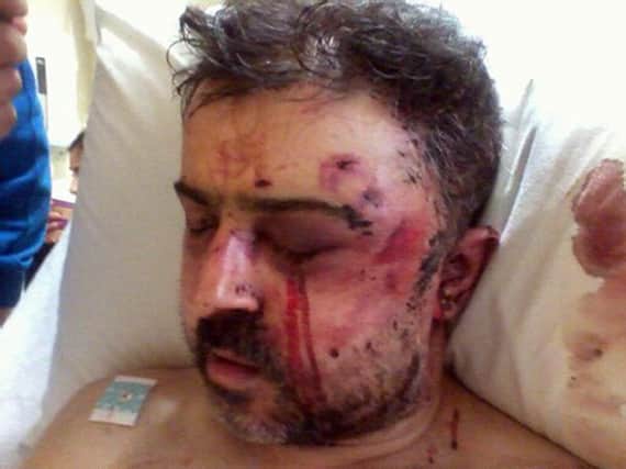 Photo issued by Northumbria Police of David Basrai, and the terrible injuries inflicted on the shopkeeper when he fought off two would-be robbers.
