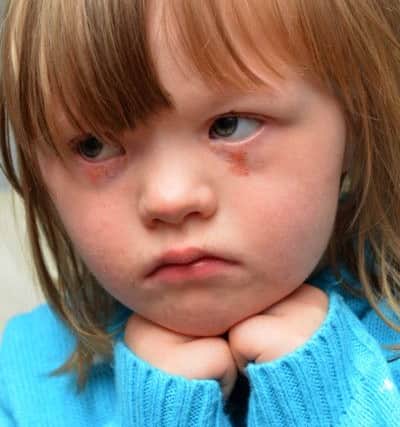 Skye Preston, seven, who has Downs Syndrome was attacked outside Sunderland Eye Infirmary.