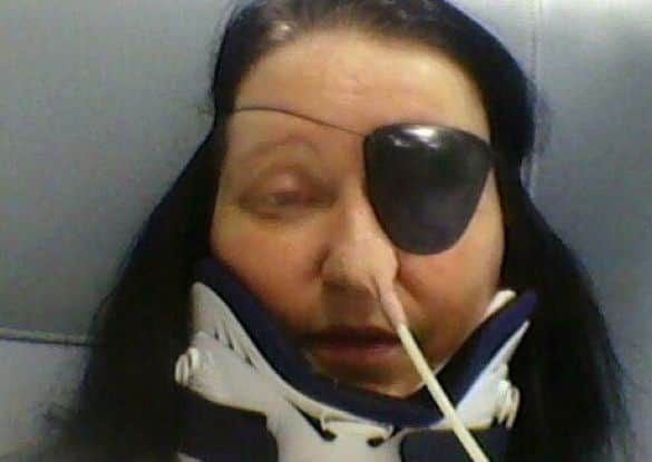 Julie Johnson pictured in hospital following the collision.