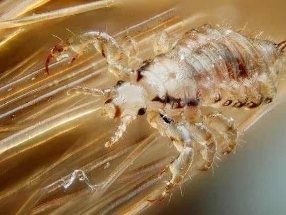 What are head lice?