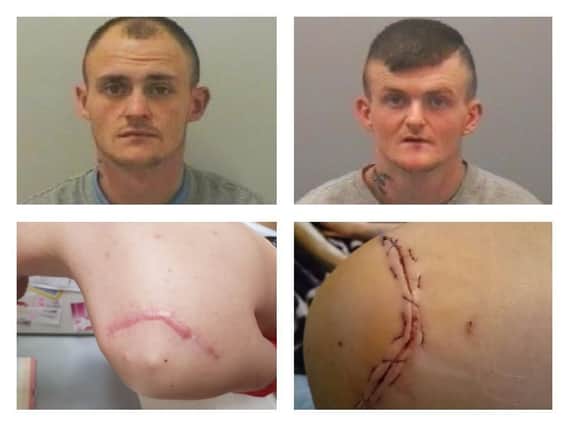 Tony and Ricky Duddin (top left and right). Below are pictures issued by the police of injuries suffered by the victim